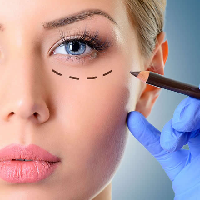 BLEFAROPLASTIA EN GUAYAQUIL